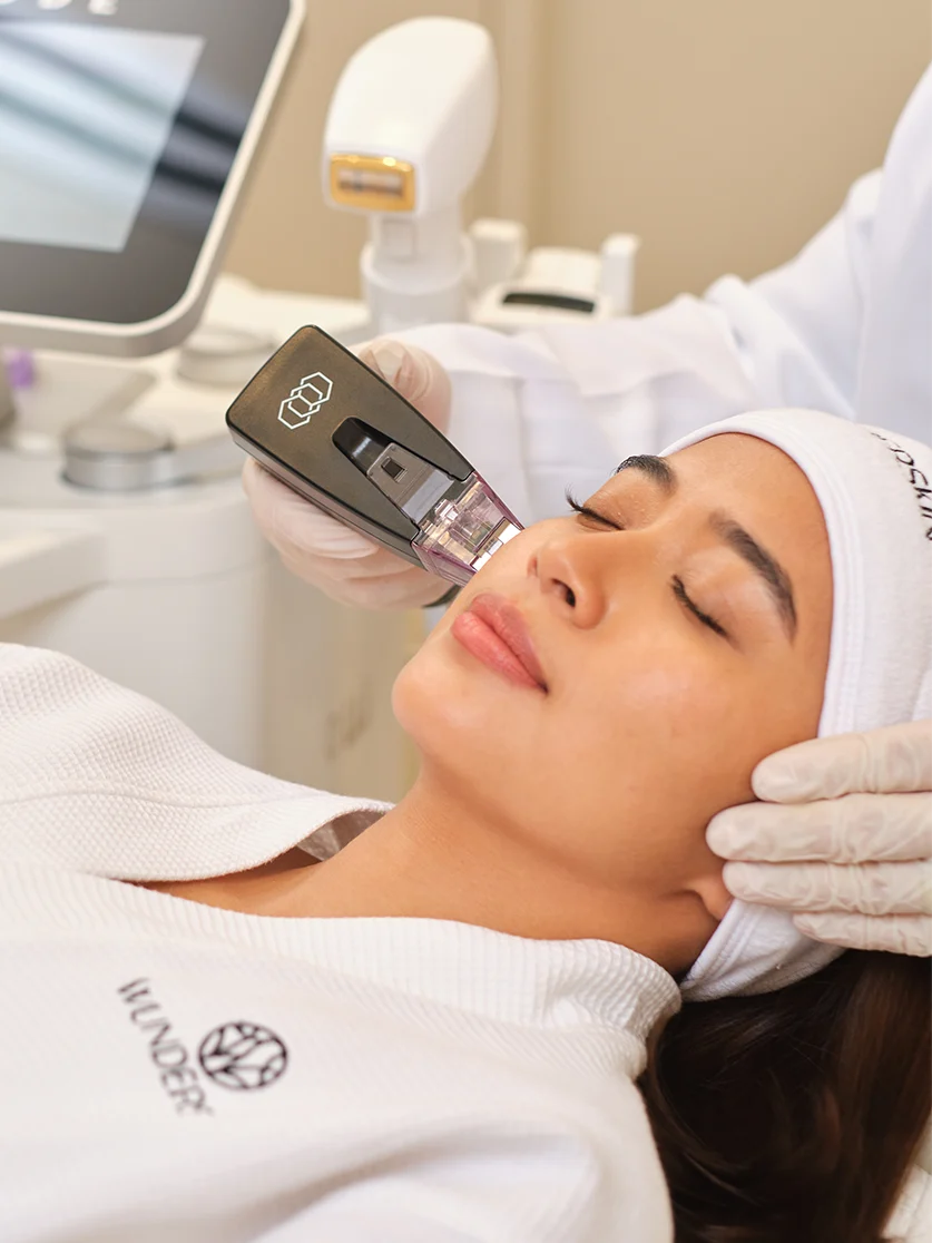 Morpheus8 treatment results and skin renewal