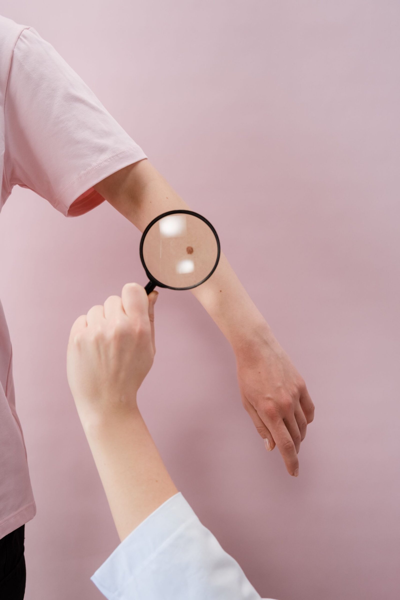 Clear skin after professional mole removal