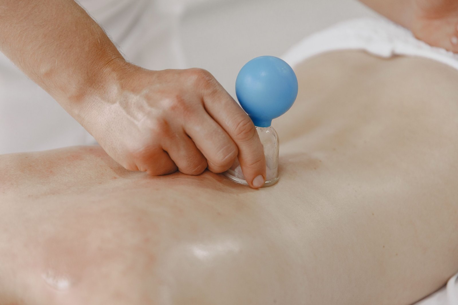 Hijama cupping therapy treatment session