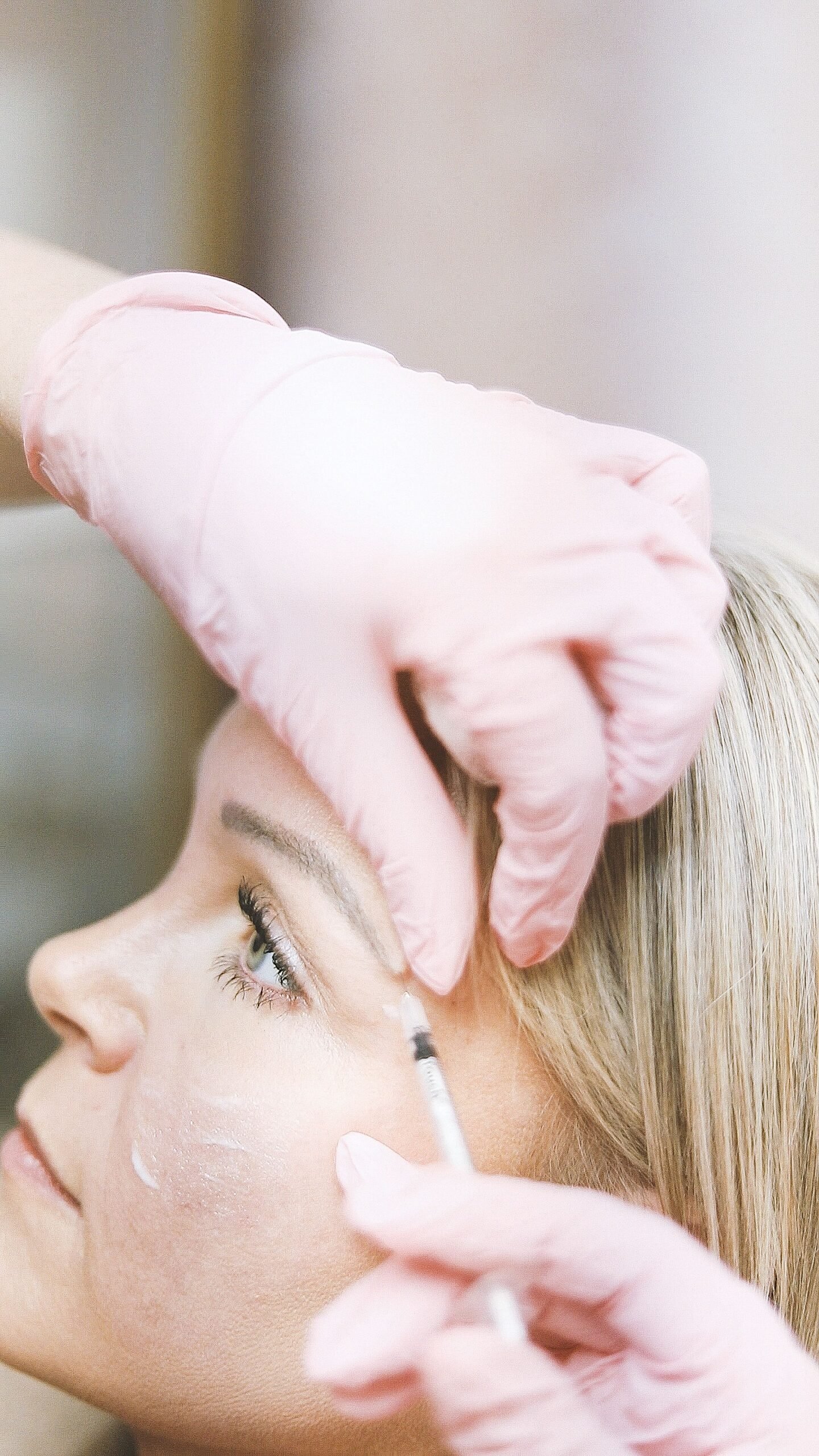 Smooth radiant skin after professional Botox treatment