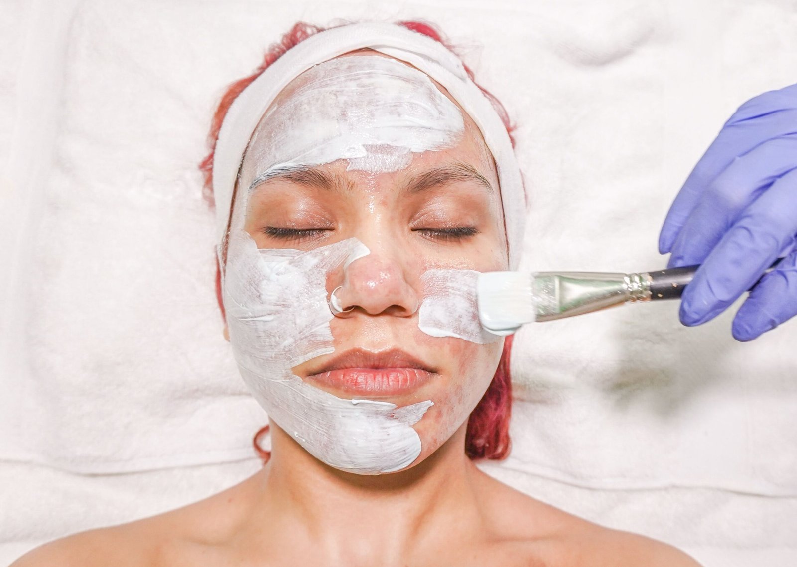 Professional chemical peel application and skin rejuvenation session