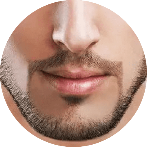 best facelift for men in faisalabad